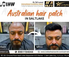Top Quality Australian hair patch in Salt Lake | Indian Hair World Salt Lake