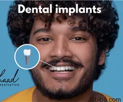 Dental implants cost in Coimbatore